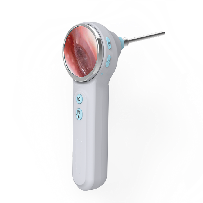 Vividia VO-102 LCD/USB/WiFi Wireless Handheld Veterinary HD Otoscope with 1.85" LCD Monitor USB Output WiFi Wireless for Android iOS Windows