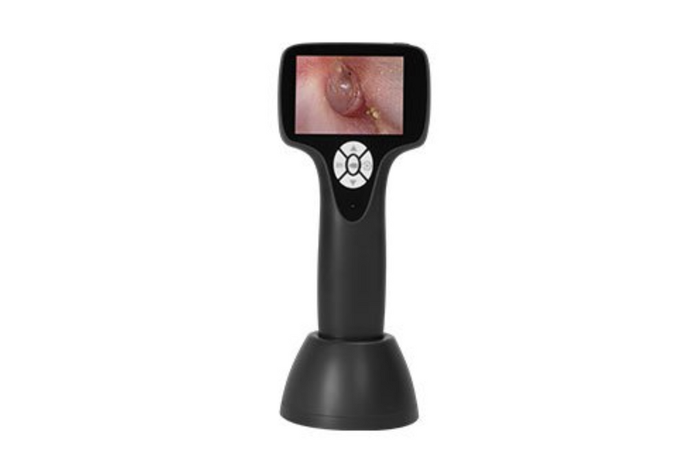 Vividia VO-103 LCD/USB Portable Handheld Veterinary HD Otoscope with 3" LCD Monitor USB Output Android and PC Windows MacBook