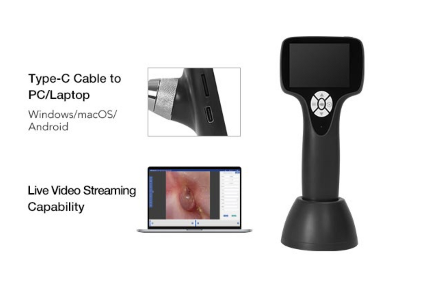 Vividia VO-103 LCD/USB Portable Handheld Veterinary HD Otoscope with 3" LCD Monitor USB Output Android and PC Windows MacBook
