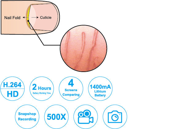Vividia NH01 Wireless Portable Microscope for Nailfold