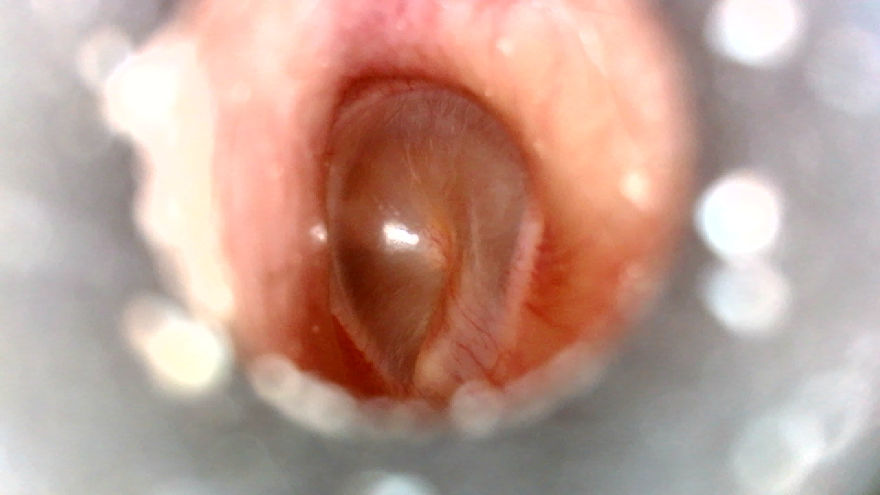 Vividia T008 USB Manual Focus Digital Video Otoscope for iPhone iPad Android PC and Mac