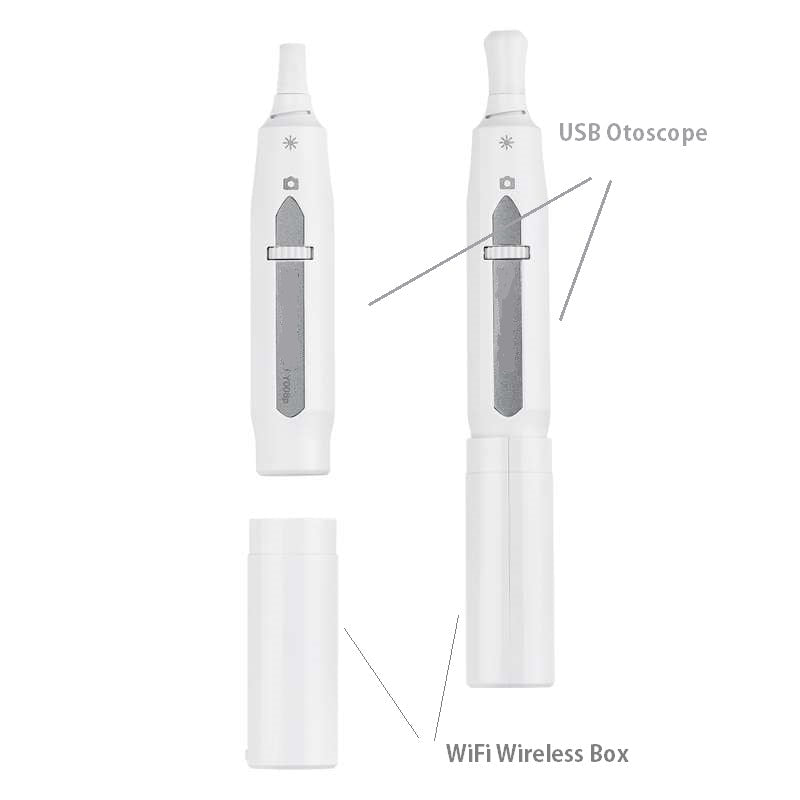 Vividia T008 USB Manual Focus Digital Video Otoscope for iPhone iPad Android PC and Mac