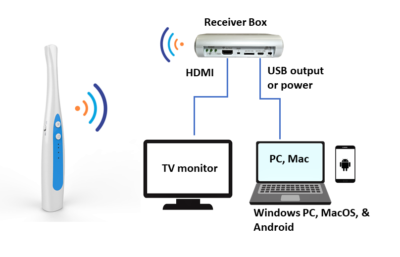 Vividia T12 Wireless Cordless USB/HDMI Dental Camera for TV monitor Android and PC/Mac