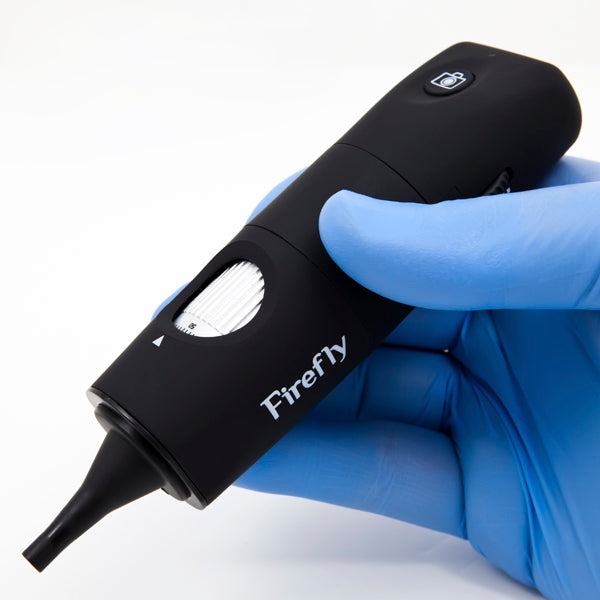 Firefly DE550 Handheld Digital Wireless Video Otoscope/ Earscope/ Auriscope