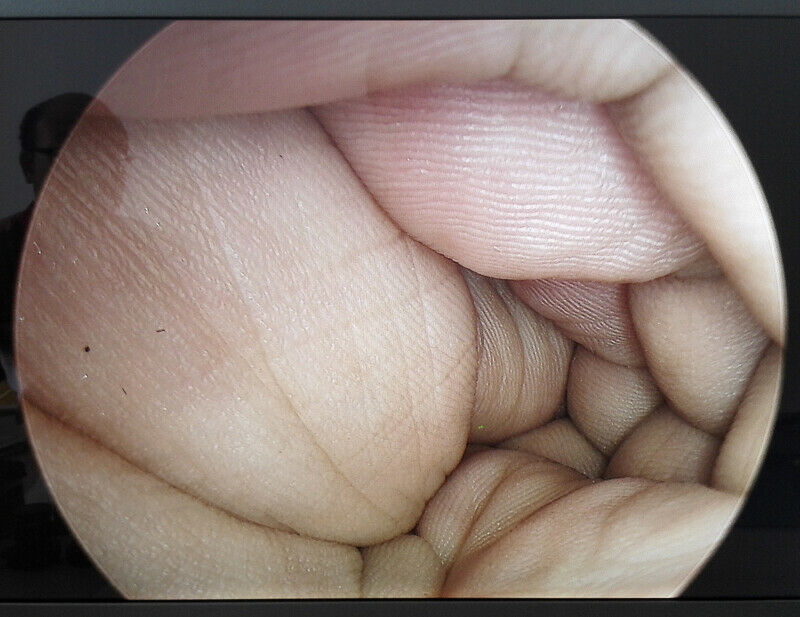 Vividia C-mount Eyepiece Camera Coupler Adapter Manual Focusable for Fiberscopes Endoscopes