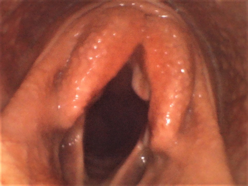 Vividia VE-2-8015 Portable Veterinary Flexible 2-Way Articulating Video Endoscope Inspection Camera with Replaceable 8mm x 1.5m Long Polyethene Probe