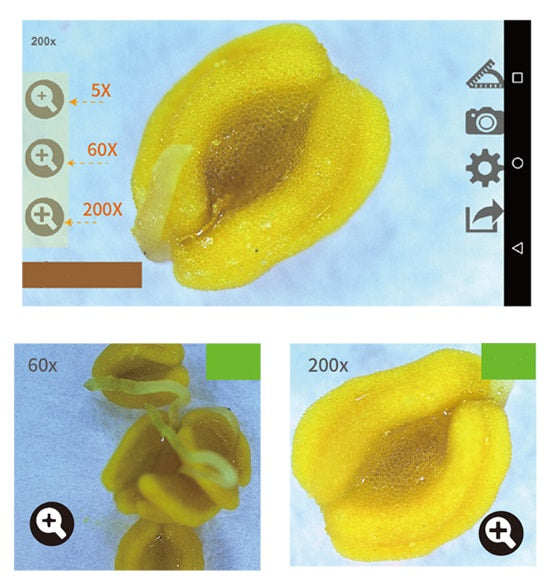 Vividia 3R-600 Portable Digital Autofocus Android Microscope with 4.7" Touch Screen and Measurement and Magnification 300x