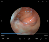 Vividia ECS-1080 USB All-in-One Endoscope Fiberscope Eyepiece Camera System with Built-in Light Source and 1920x1080 CMOS Camera and Universal Adaptor